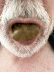 Eating Shit