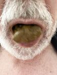 Eating Swallow Shit, Popper