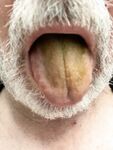 Eating Swallow Shit, Popper