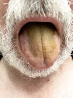 Eating Shit Swallow