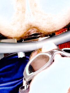 🏳️‍🌈Enemas