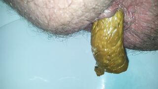 hairy arsed guy pooping